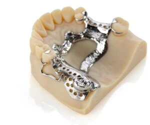 Partial Denture 11 Dental2